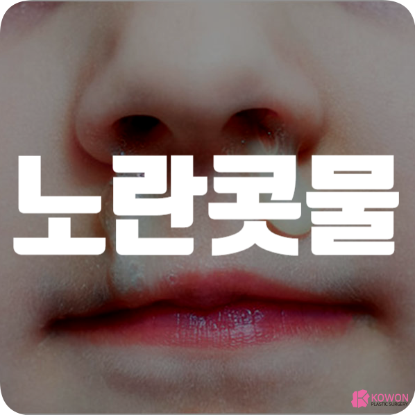노란콧물 원인 비염 축농증 냉 피 약