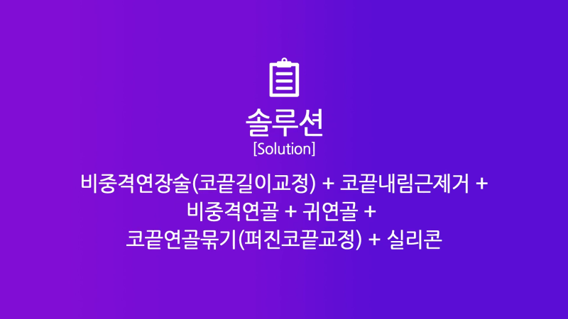 남자코끝 개선해 직선코로 다시 태어난 사례! 사진 4