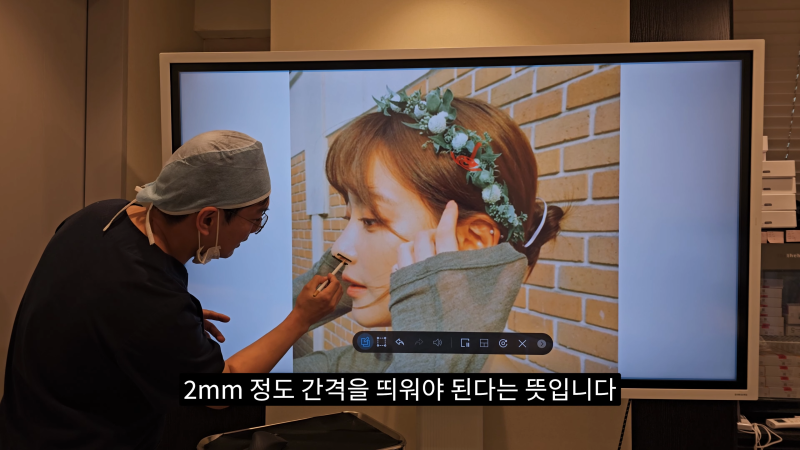 예쁜 코를 위한 비주와 콧날개에 대해 알려드립니다! 1편 사진 7