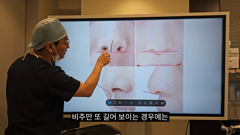 예쁜 코를 위한 비주와 콧날개에 대해 알려드립니다! 1편 사진 9