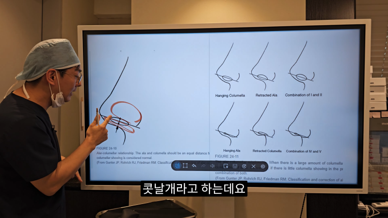 예쁜 코를 위한 비주와 콧날개에 대해 알려드립니다! 1편 사진 4