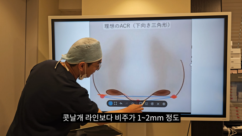 예쁜 코를 위한 비주와 콧날개에 대해 알려드립니다! 1편 사진 10