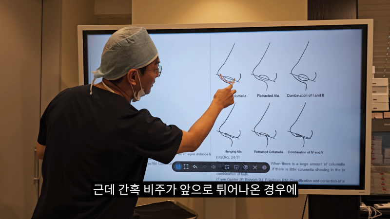 예쁜 코를 위한 비주와 콧날개에 대해 알려드립니다! 1편 사진 5