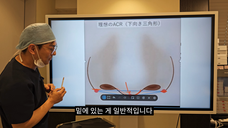 예쁜 코를 위한 비주와 콧날개에 대해 알려드립니다! 1편 사진 11