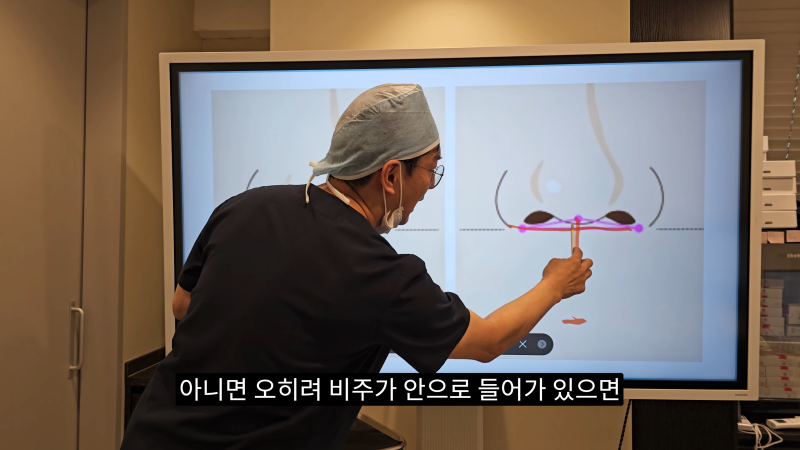 예쁜 코를 위한 비주와 콧날개에 대해 알려드립니다! 1편 사진 12