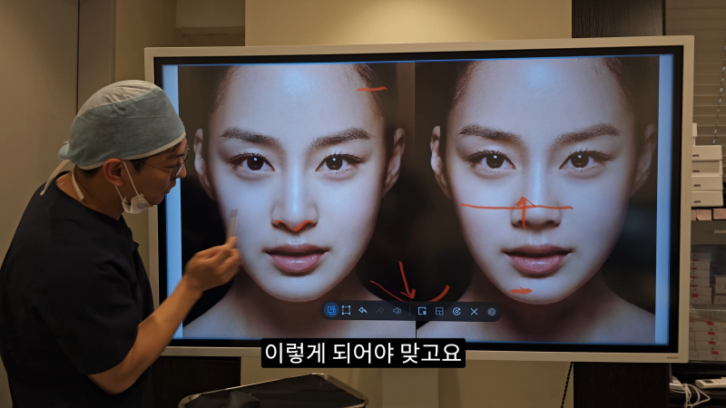 예쁜 코를 위한 비주와 콧날개에 대해 알려드립니다! 1편 사진 14