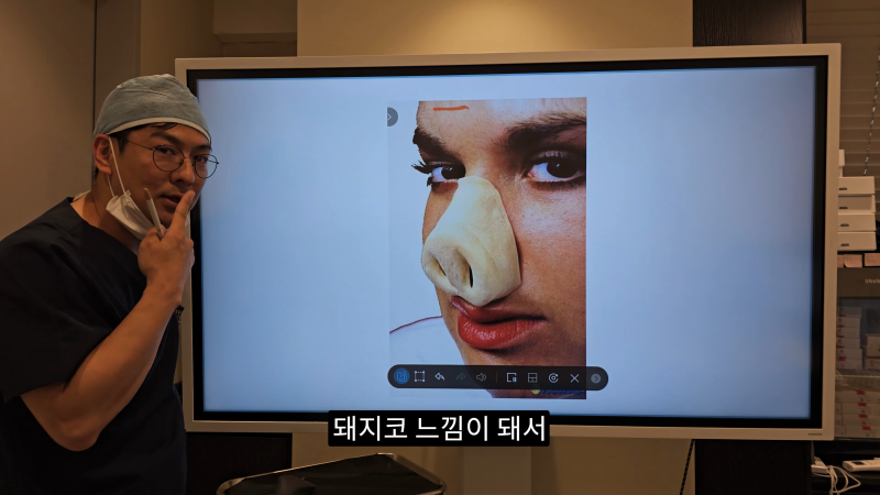 예쁜 코를 위한 비주와 콧날개에 대해 알려드립니다! 1편 사진 16