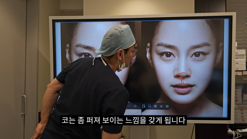 예쁜 코를 위한 비주와 콧날개에 대해 알려드립니다! 1편 사진 15