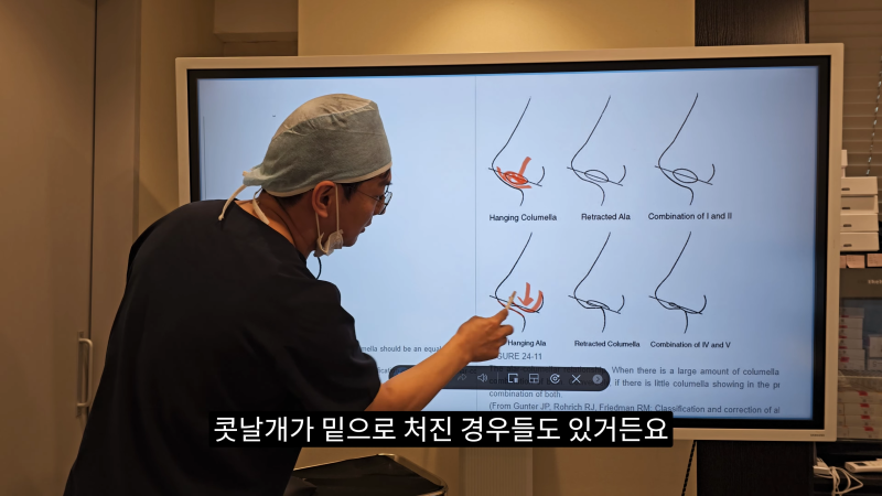 예쁜 코를 위한 비주와 콧날개에 대해 알려드립니다! 1편 사진 6