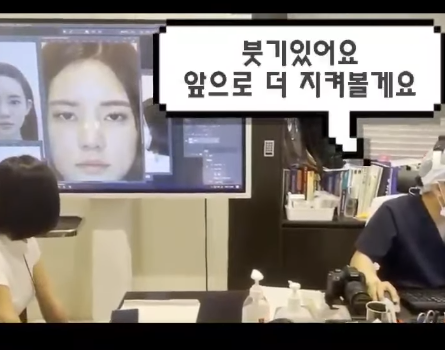 코수술 당일 진행 과정과 2주 차 경과 모습 원장님과 같이 확인했어요! 사진 11