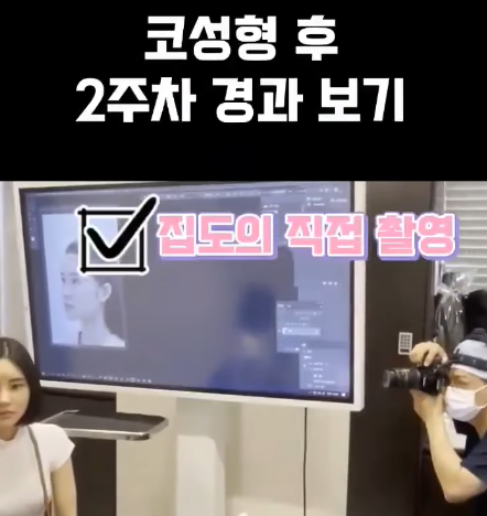 코수술 당일 진행 과정과 2주 차 경과 모습 원장님과 같이 확인했어요! 사진 6
