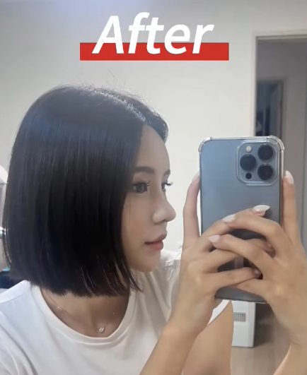코수술 당일 진행 과정과 2주 차 경과 모습 원장님과 같이 확인했어요! 사진 13