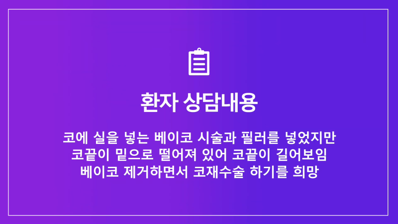 쁘띠시술 베이코 제거 후 코 성형한 후기! 사진 5