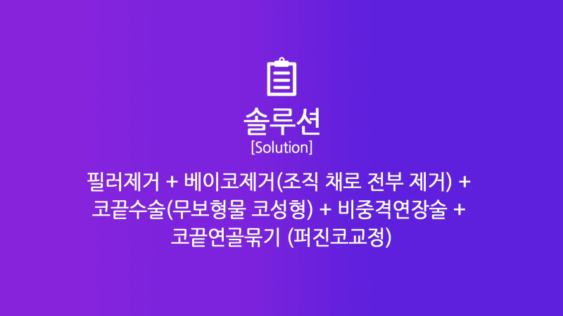 쁘띠시술 베이코 제거 후 코 성형한 후기! 사진 6