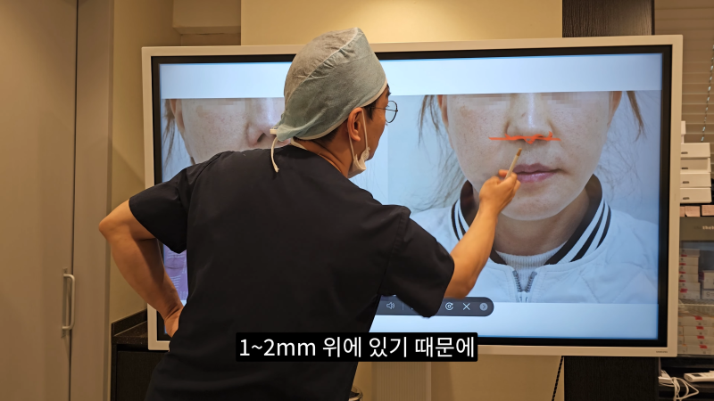 예쁜 코를 위한 비주와 콧날개에 대해 알려드립니다! 2편 (넓은코, 처진콧날개) 사진 3