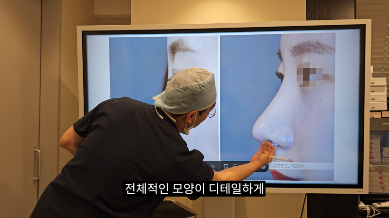 예쁜 코를 위한 비주와 콧날개에 대해 알려드립니다! 2편 (넓은코, 처진콧날개) 사진 17