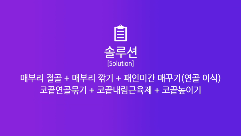 남성 매부리코 교정과 코끝성형을 통해 깔끔하고 멋진 콧대 만들기! 사진 3