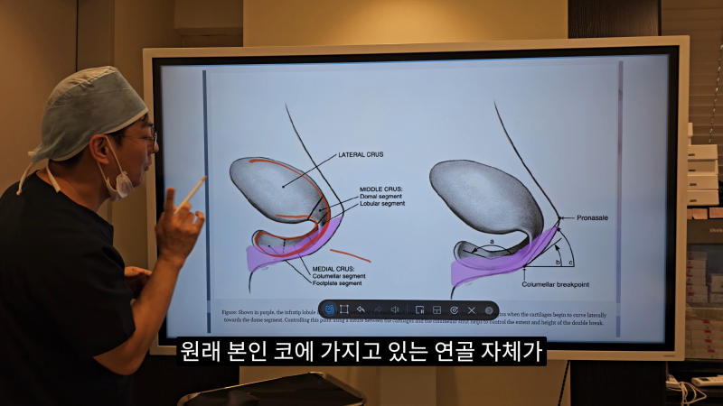 예쁜 코를 위한 비주와 콧날개에 대해 알려드립니다! 마지막 편! (사각코 모양) 사진 9