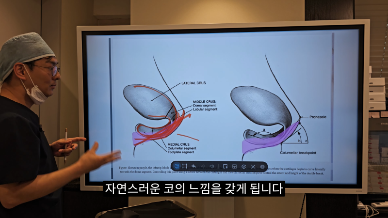 예쁜 코를 위한 비주와 콧날개에 대해 알려드립니다! 마지막 편! (사각코 모양) 사진 10