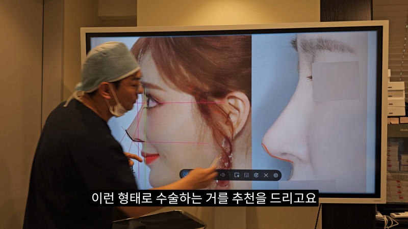 예쁜 코를 위한 비주와 콧날개에 대해 알려드립니다! 마지막 편! (사각코 모양) 사진 15