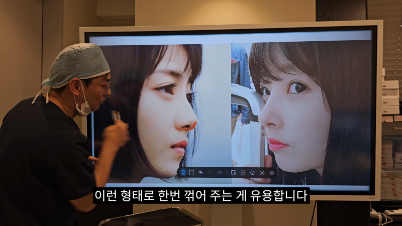 예쁜 코를 위한 비주와 콧날개에 대해 알려드립니다! 마지막 편! (사각코 모양) 사진 12