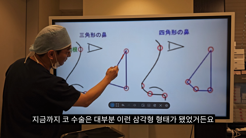 예쁜 코를 위한 비주와 콧날개에 대해 알려드립니다! 마지막 편! (사각코 모양) 사진 4