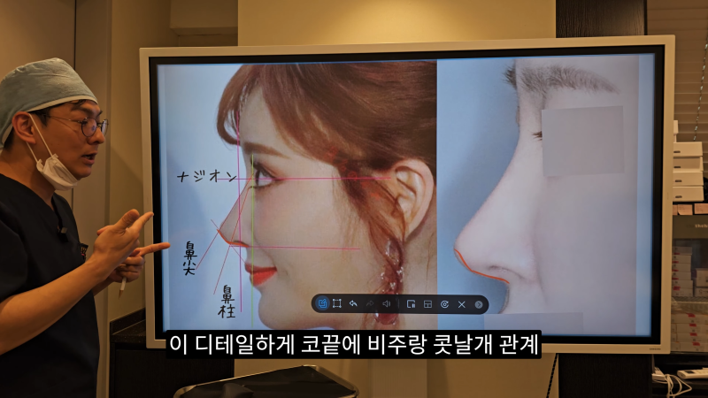 예쁜 코를 위한 비주와 콧날개에 대해 알려드립니다! 마지막 편! (사각코 모양) 사진 13