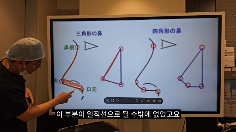 예쁜 코를 위한 비주와 콧날개에 대해 알려드립니다! 마지막 편! (사각코 모양) 사진 6