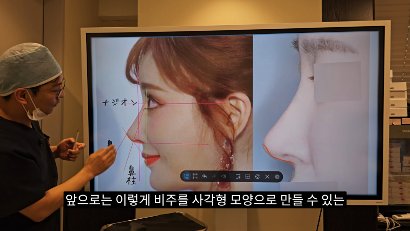 예쁜 코를 위한 비주와 콧날개에 대해 알려드립니다! 마지막 편! (사각코 모양) 사진 14