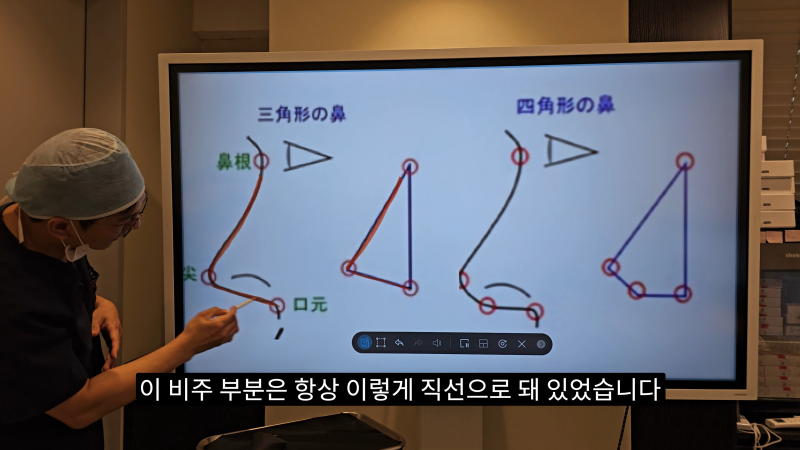 예쁜 코를 위한 비주와 콧날개에 대해 알려드립니다! 마지막 편! (사각코 모양) 사진 5