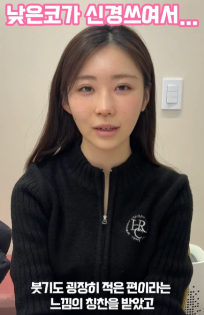 낮은코, 옆태 라인 개선하고 싶어서 일본에서 왔어요! 사진 8