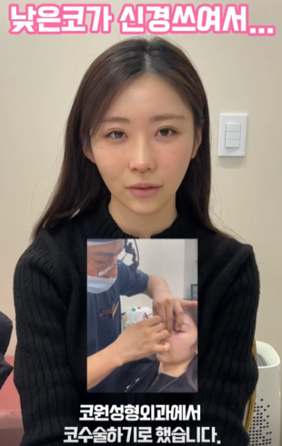 낮은코, 옆태 라인 개선하고 싶어서 일본에서 왔어요! 사진 6