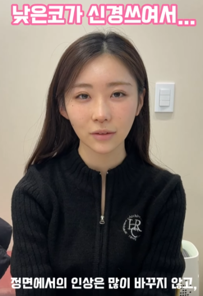 낮은코, 옆태 라인 개선하고 싶어서 일본에서 왔어요!
