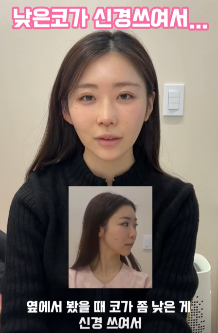 낮은코, 옆태 라인 개선하고 싶어서 일본에서 왔어요!