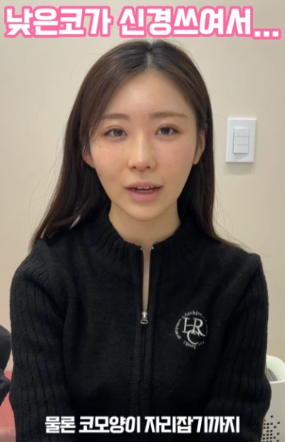 낮은코, 옆태 라인 개선하고 싶어서 일본에서 왔어요! 사진 10