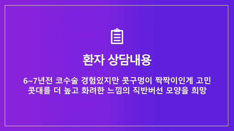 콧구멍짝짝이 개선, 화려한 직반버선코로 코재수술한 분의 후기!