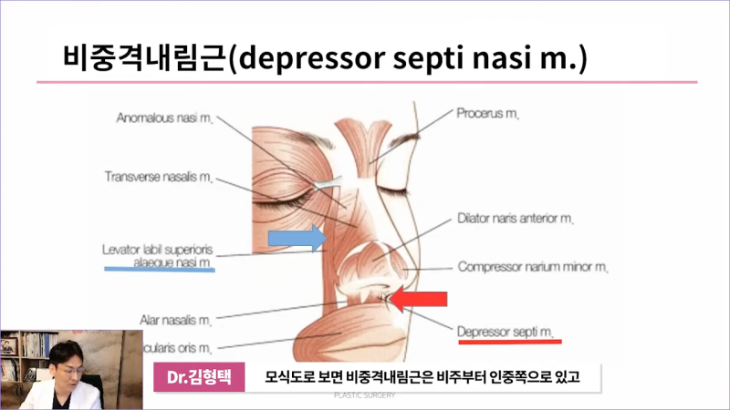 화살코교정의 핵심은 비중격내림근과 상순비익올림근 제거입니다. 이 근육들을 절단하지 않으면 어떻게 될까요? 사진 3