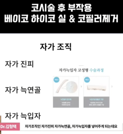 베이코/하이코 시술 부작용으로 실 제거와 필러 제거에 대하여-1편 사진 4