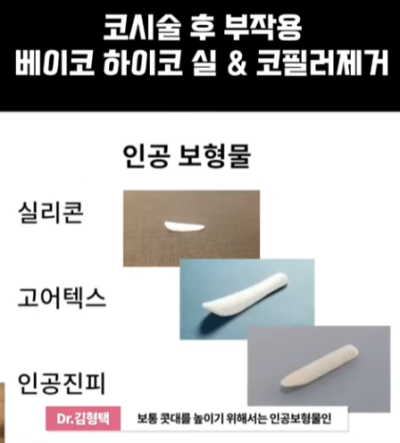 베이코/하이코 시술 부작용으로 실 제거와 필러 제거에 대하여-1편 사진 3