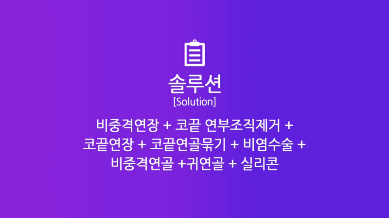 코끝연장과 보형물로 남자복코 개선한 후기! 사진 4