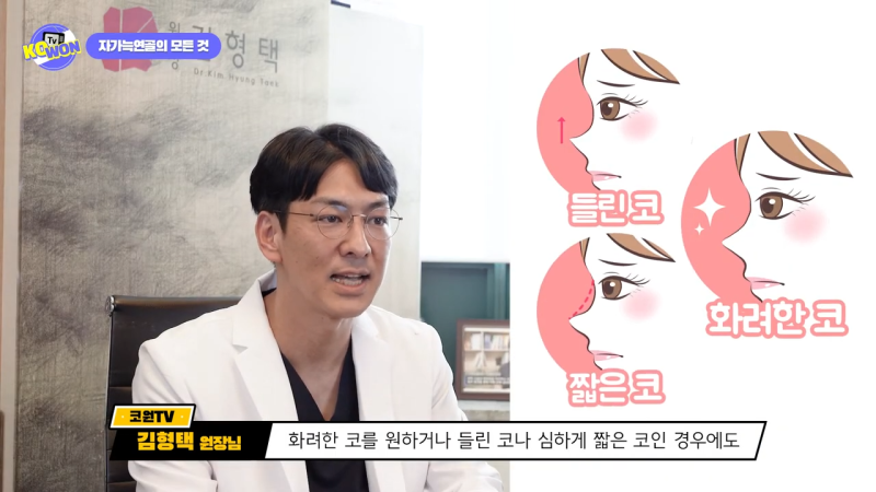 코 수술, 자가늑연골의 장점과 단점, 사용하기 적합한 경우는? - 1탄 사진 9