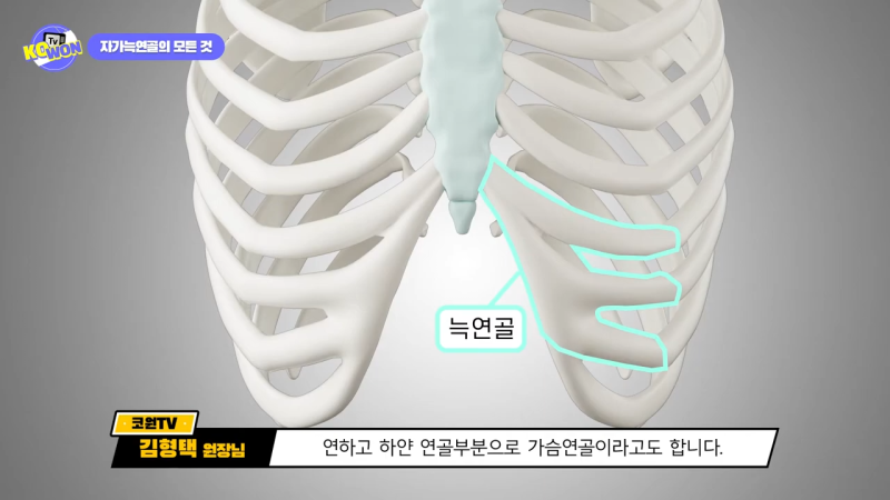 코 수술, 자가늑연골의 장점과 단점, 사용하기 적합한 경우는? - 1탄 사진 3