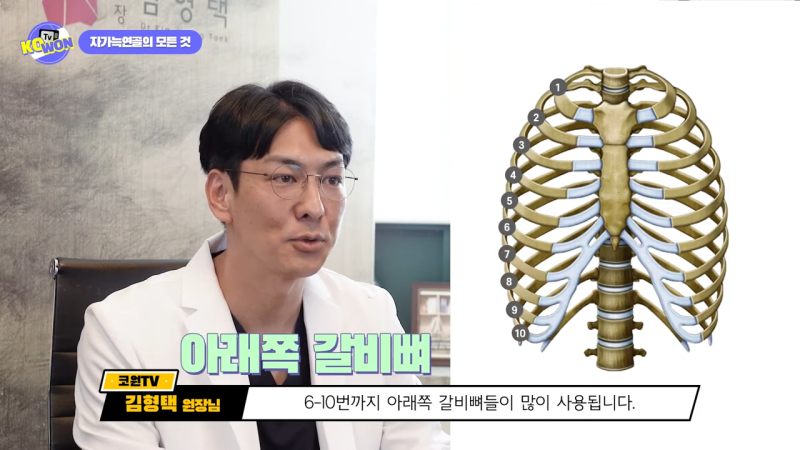 코 수술, 자가늑연골의 장점과 단점, 사용하기 적합한 경우는? - 1탄 사진 4