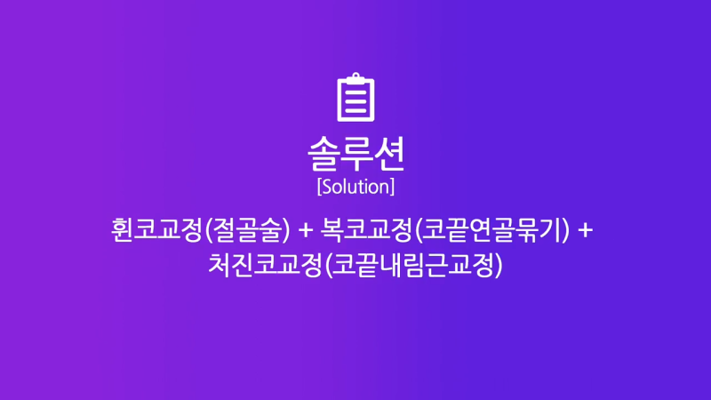 여자 복코, 코끝연골묶기로 개선! 사진 4