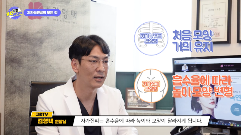 코 수술, 자가늑연골의 장점과 단점, 사용하기 적합한 경우는? - 2탄 사진 5