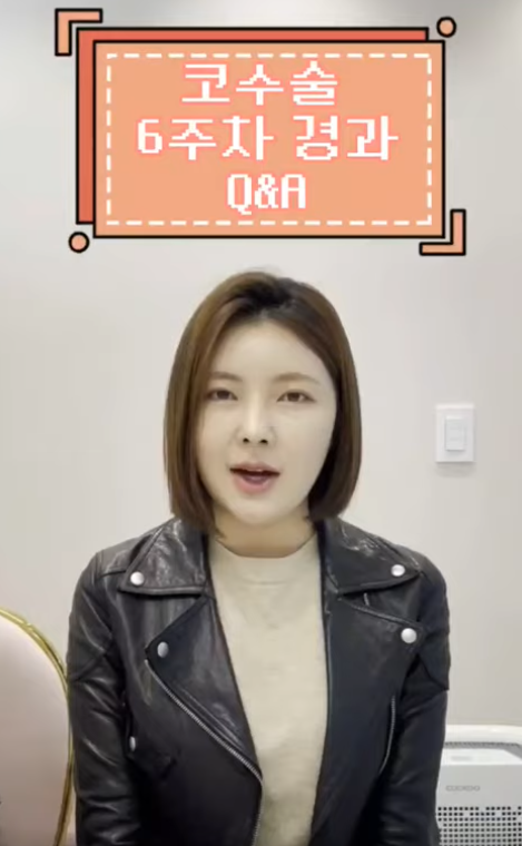 자가늑으로 코성형 후 6주차 경과 Q&A