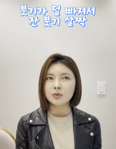 자가늑으로 코성형 후 6주차 경과 Q&A 사진 10