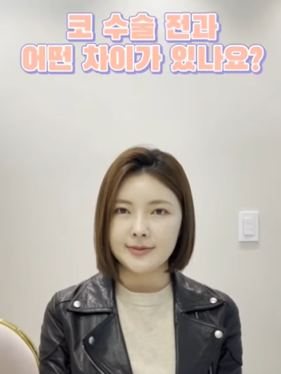 자가늑으로 코성형 후 6주차 경과 Q&A 사진 5