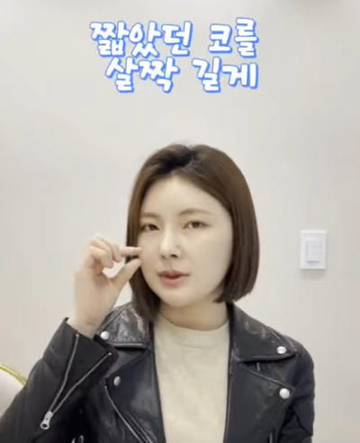 자가늑으로 코성형 후 6주차 경과 Q&A 사진 4
