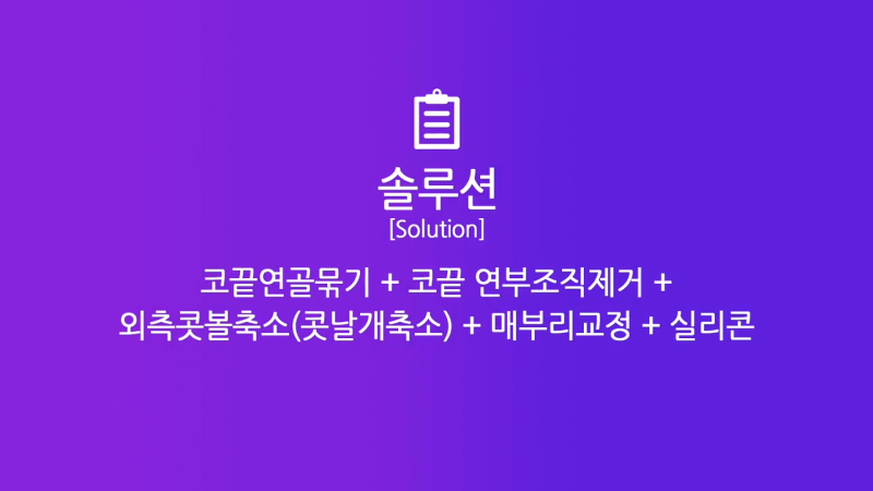 코끝 연골 묶기 + 실리콘으로 남자복코 개선했습니다! 사진 4